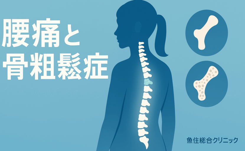 腰痛と骨粗鬆症